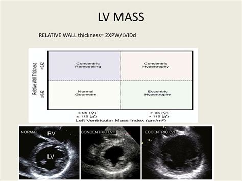 lv freewall thickness echocardiography|left ventricular thickness mri.